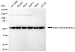 SCP2 Antibody in Western Blot (WB)