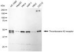 TBXA2R Antibody in Western Blot (WB)