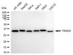 TRADD Antibody in Western Blot (WB)