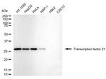 TCF21 Antibody in Western Blot (WB)