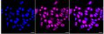 TRPV5 Recombinant Rabbit Monoclonal Antibody (24GB1850)