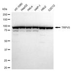 TRPV5 Antibody in Western Blot (WB)