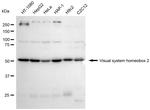 CHX10 Antibody in Western Blot (WB)