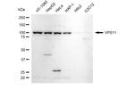 VPS11 Antibody in Western Blot (WB)