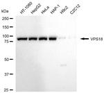 VPS18 Antibody in Western Blot (WB)
