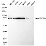 Kaiso Antibody in Western Blot (WB)