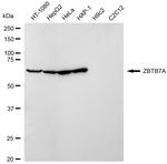 Pokemon Antibody in Western Blot (WB)