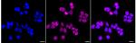ZNF217 Antibody in Immunocytochemistry (ICC/IF)