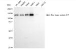 ZNF217 Antibody in Western Blot (WB)