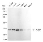 Aldolase A Recombinant Rabbit Monoclonal Antibody (24GB4710)