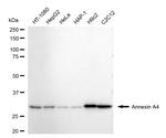 Annexin A4 Recombinant Rabbit Monoclonal Antibody (24GB4715)