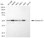 Annexin A11 Monoclonal Antibody (24GB6225)