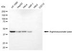 ASL Antibody in Western Blot (WB)