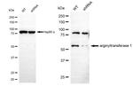 ATE1 Antibody in Western Blot (WB)