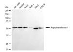 ATE1 Antibody in Western Blot (WB)