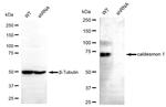 Caldesmon Antibody in Western Blot (WB)