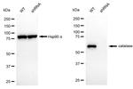 Catalase Antibody in Western Blot (WB)