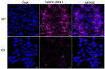 delta Catenin Antibody in Immunocytochemistry (ICC/IF)