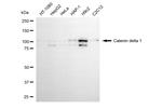 delta Catenin Monoclonal Antibody (24GB5775)