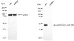 CDC123 Antibody in Western Blot (WB)
