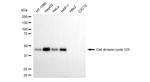 CDC123 Antibody in Western Blot (WB)