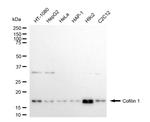 Cofilin Recombinant Rabbit Monoclonal Antibody (24GB4775)