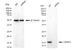 CRABP2 Antibody in Western Blot (WB)