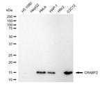 CRABP2 Antibody in Western Blot (WB)