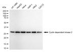 CDK2 Recombinant Rabbit Monoclonal Antibody (24GB4315)