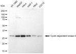 CDK4 Antibody in Western Blot (WB)