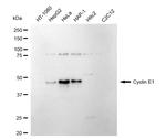Cyclin E Antibody in Western Blot (WB)