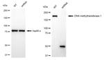 DNMT1 Antibody in Western Blot (WB)