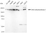 DNMT1 Antibody in Western Blot (WB)
