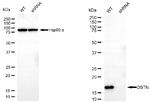 Destrin Antibody in Western Blot (WB)