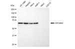 PKR Monoclonal Antibody (24GB5880)