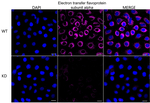 ETFA Antibody in Immunocytochemistry (ICC/IF)