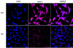 GIPC1 Antibody in Immunocytochemistry (ICC/IF)