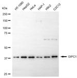 GIPC1 Monoclonal Antibody (24GB6645)
