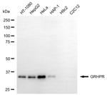 GRHPR Monoclonal Antibody (24GB6270)