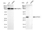 GTF2F2 Antibody in Western Blot (WB)