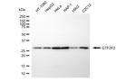 GTF2F2 Antibody in Western Blot (WB)