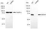 HADHA Antibody in Western Blot (WB)