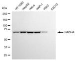 HADHA Monoclonal Antibody (24GB6655)