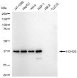 CECR5 Antibody in Western Blot (WB)