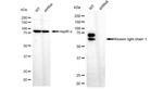 KLC1 Antibody in Western Blot (WB)