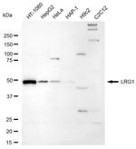 LRG1 Antibody in Western Blot (WB)