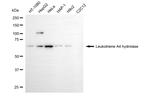 LTA4H Monoclonal Antibody (24GB5535)