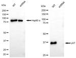 LAT Antibody in Western Blot (WB)