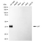 LAT Antibody in Western Blot (WB)