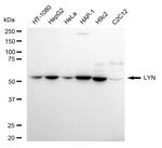 Lyn Antibody in Western Blot (WB)